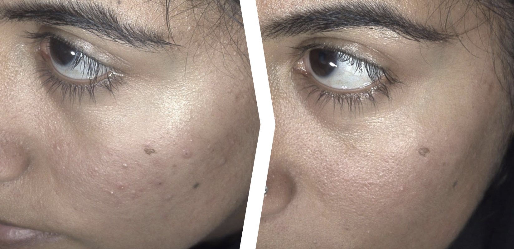 MediLUX Before and After